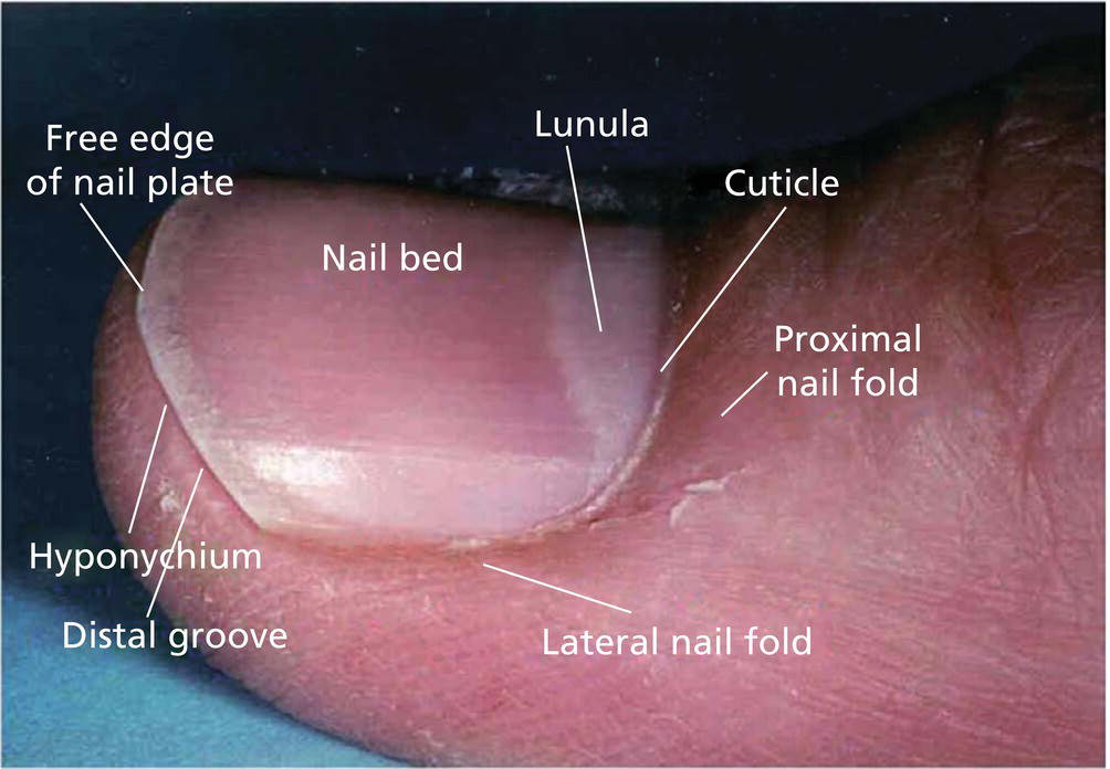 Schematic illustration of nail unit with lines indicating important structures.