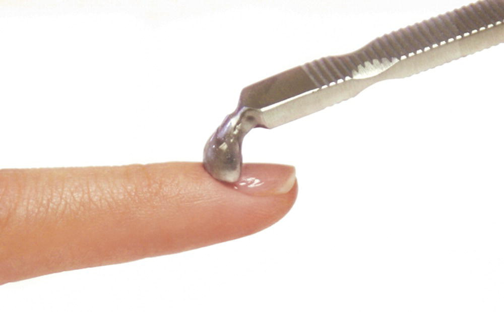 Schematic illustration of be careful with the cuticle.