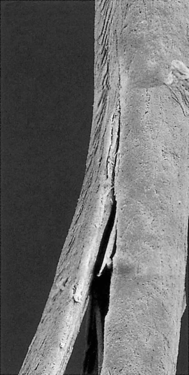 Schematic illustration of the worn cuticle-free split end of hair (SEM × 800).