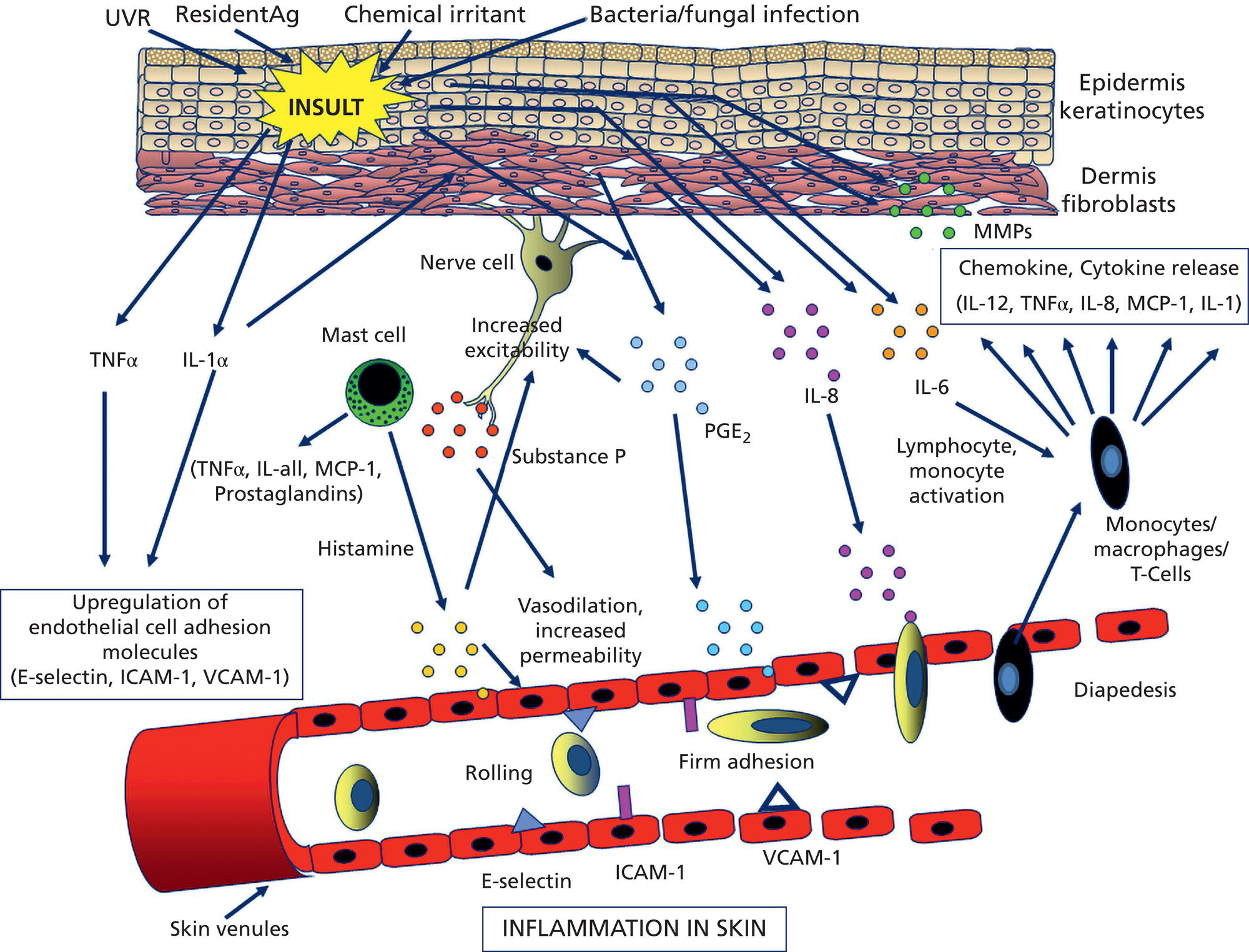 Schematic illustration of skin inflammation pathway.