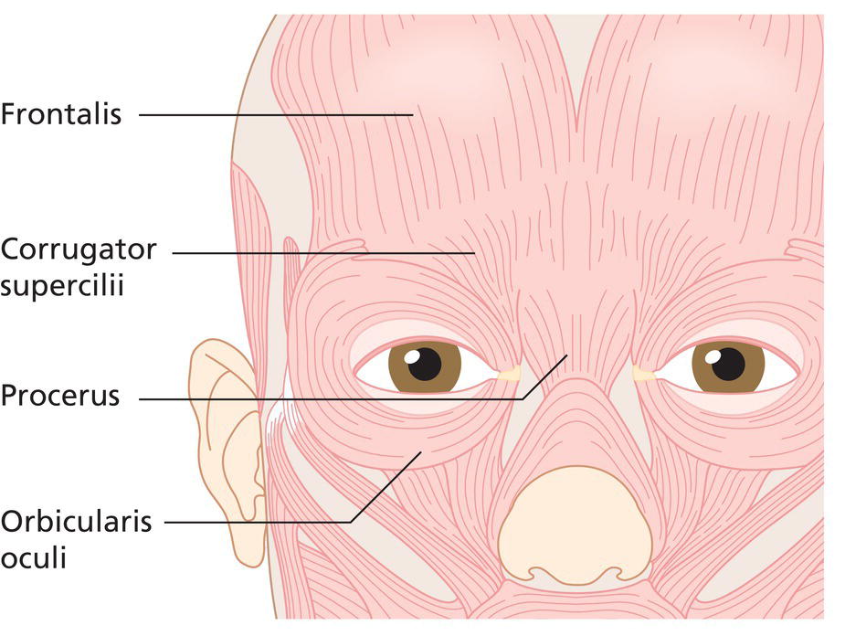 Schematic illustration of relevant musculature of the upper face.