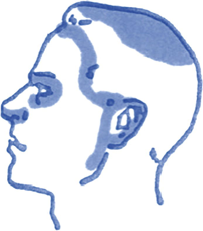 Schematic illustration of areas where sunscreen is often not adequately applied, as well as on the fingertips, neck, upper chest, and back.