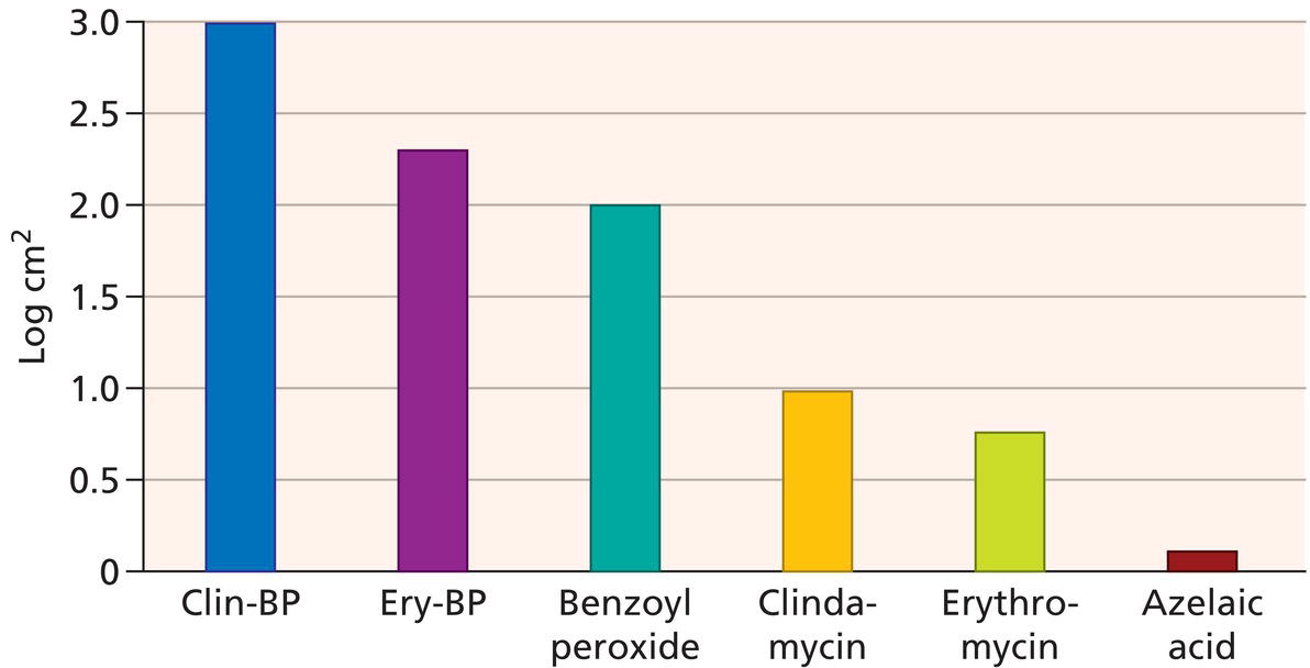 Schematic illustration of reduction in Propionibacterium acnes with topical therapy.