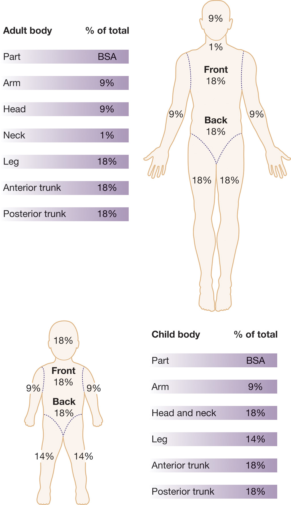 A diagram shows the rule of nines method for calculating total body surface area burned in adults and children, with body percentages. The diagram shows the rule of nines assessment method used to estimate burn size, displaying body surface area percentages for both adult and child body types. The diagram includes simplified human figures with labeled body regions and corresponding tables listing body parts and percentage of total B S A. For adults, the head represents 9%, each arm 9%, the front torso 18%, the back torso 18%, each leg 18%, and the perineum 1%. For children, the proportions differ with the head and neck comprising 18%, each arm 9%, the front and back torso each 18%, and each leg 14%.