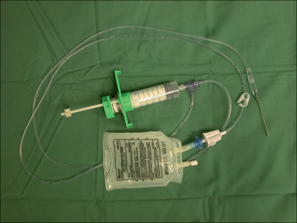 A capture of a medical infusing device with a plastic syringe, a fluid bag, and connecting tubes placed on a surface. A thin, long needle connected to a tubing system, which is on the far right.