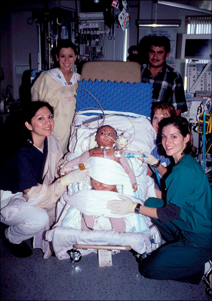A photo depicts five people positioned around a baby lying on a tilted bed with multiple tubes inserted in the chest and nose, facing the camera.