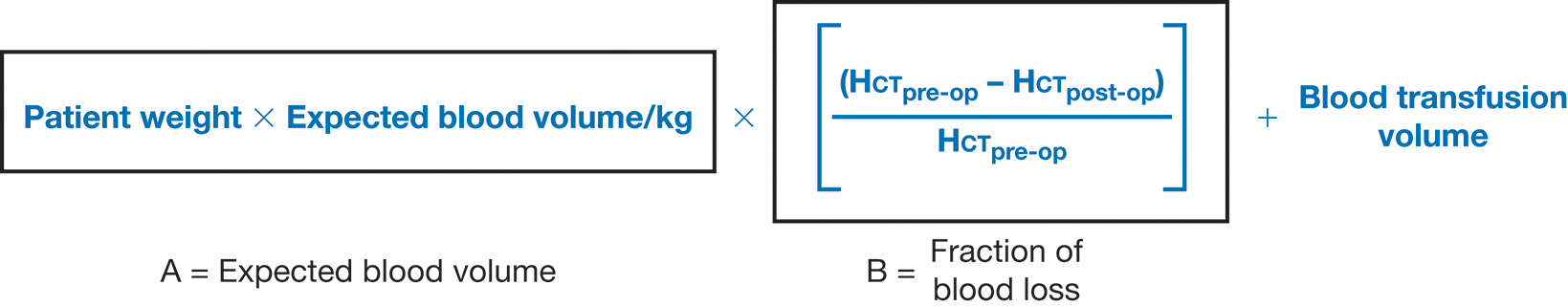 A calculation depicts blood loss using expected blood volume, fraction of blood loss from H C T values, and transfused blood volume. The calculation depicts that A represents the expected blood volume. It is calculated as the patient’s weight multiplied by the expected blood volume per kilogram of whole blood. B represents the fraction of blood loss and is calculated as open parenthesis H C T subscript pre dash op minus H C T subscript post dash op close parenthesis divided by H C T subscript pre dash op. The total blood loss is then calculated as A multiplied by B, plus the volume of blood transfused.