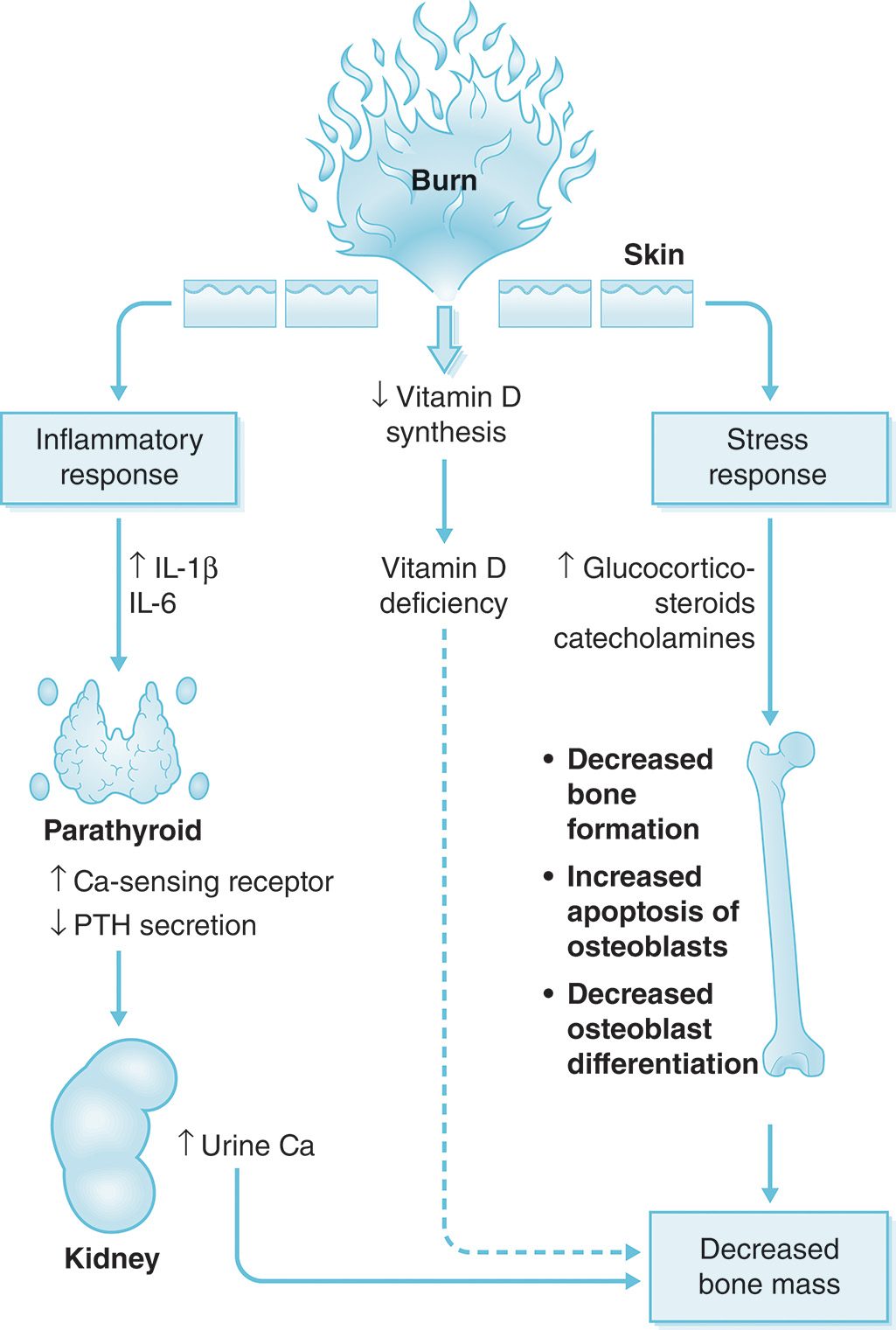 A diagram highlights how burn-induced vitamin D deficiency, inflammation, and stress hormones contribute to decreased bone mass and impaired bone metabolism. The burn injury leads to decreased vitamin D synthesis, resulting in vitamin D deficiency. The inflammatory response increases interleukin-1 beta and interleukin-6, while the stress response elevates glucocorticoids and catecholamines. These changes decrease bone formation, increase apoptosis of osteoblasts, and reduce osteoblast differentiation. Additionally, there is upregulation of calcium-sensing receptors in the parathyroid, leading to decreased P T H secretion and increased urinary calcium excretion by the kidney. All are collectively responsible for decreased bone mass.