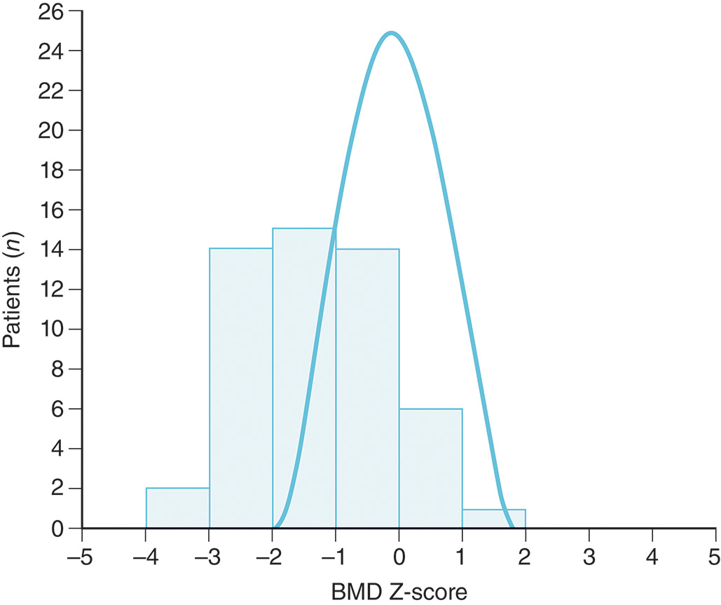 A multi-graph showing a parabolic curve and histogram with n on one axis and B M D Z score on the other, depicting values ranging from negative five to five. The multi graph shows the vertical axis labeled n ranging from zero to twenty-six in increments of two, and a second vertical axis marked B M D Z score, ranging from negative five to five in increments of one. The graph displays a parabolic curve along with a histogram. Histogram values are approximately: (two, negative four), (fourteen, negative three), (fifteen, negative two), (thirteen point nine, negative one), (six, zero), and (one, one). The parabolic curve reaches its highest peak at approximately (twenty-five, zero).