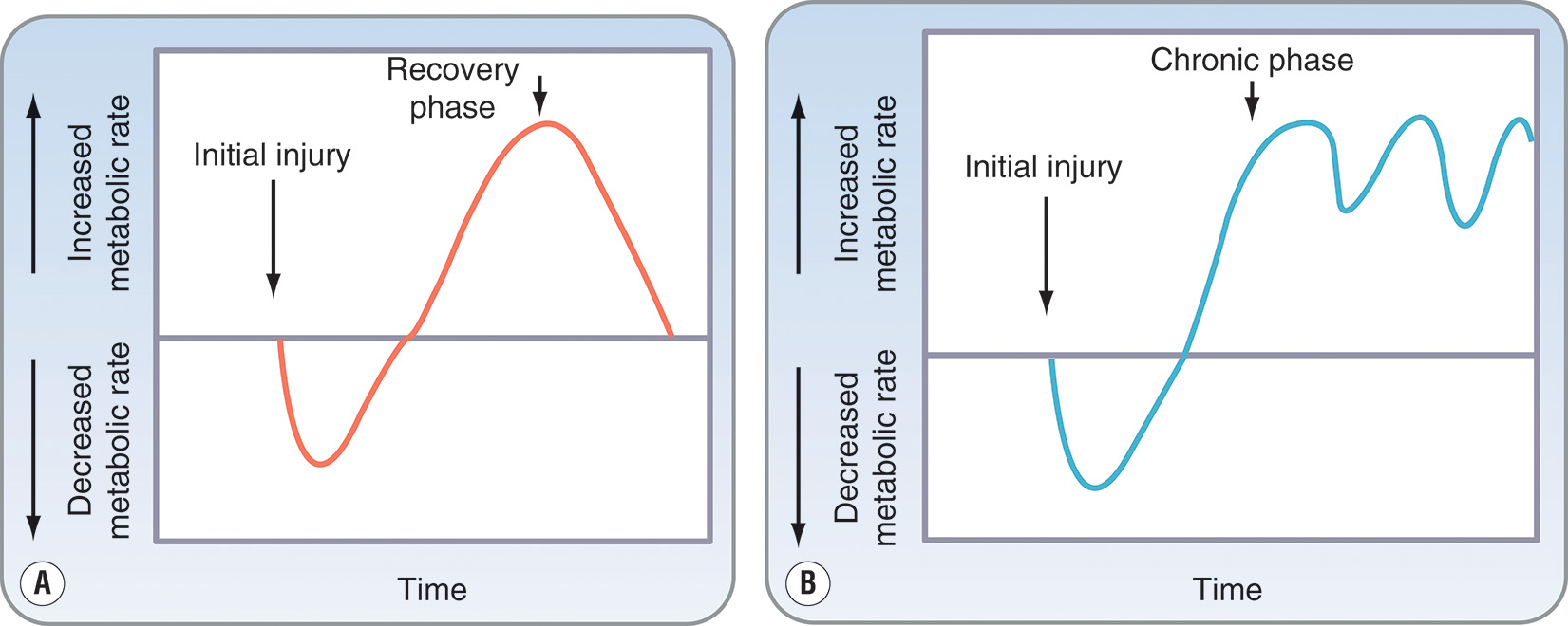 A set of two line graphs showing changes in metabolic rate over time after injury, comparing initial, recovery, and chronic hypermetabolic phases. The two line graphs labeled A and B compare how the body’s metabolic rate changes after an injury or burn. Both graphs have the vertical axis labeled Metabolic rate divided into two halves, the upper one labeled increased metabolic rate, and the lower one labeled decreased metabolic rate, and the horizontal axis labeled Time. In the first graph, labeled A, the line begins with a short downward dip called the ebb phase, which represents a fall in metabolic rate right after injury. It is followed by a sharp upward rise called the flow phase, showing increased energy use as the body starts to recover. The curve then slowly returns to normal during the recovery phase. In the second graph, labeled B, the pattern is more irregular and wavy, showing repeated ups and downs of the metabolic rate during a chronic phase, but it is the same as the first graph in the injury phase.