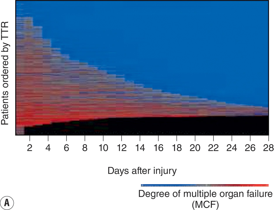 A four-panel view with two heat maps and two bar charts showing temporal leukocyte gene-expression variation after injury, with labeled pathways that are upregulated or downregulated. The view contains four panels labeled A through D. Panel A is titled degree of multiple organ failure and plots days after injury from 0 to 28 along the x-axis and pathways ordered by time to recovery along the y-axis. Rectangular bands fill the grid, forming horizontal zones of varying density that diminish over time from left to right. A key below indicates relative activation level by intensity gradient. Panel B is titled Effect of severe blunt injury on probe expression. The x-axis is labeled days after injury from 1 to 28, and the y-axis lists probe positions numbered from 0 to 30 centimeters. Vertical bands of alternating density extend across the panel. A scale bar to the right shows a numerical range from negative 2 to 6, indicating relative expression intensity. Panel C is titled upregulated pathways with a horizontal axis labeled log p value 0 to 14. Ten horizontal bars extend from left to right and are labeled integrin signaling, leukocyte extravasation, Fc gamma receptor mediated phagocytosis, I L 1 signaling, toll like receptor signaling, ephrin receptor signaling, I L 6 signaling, T R E M 1 signaling, actin cytoskeleton signaling, and B cell receptor signaling. Longer bars appear at the top of the chart. Panel D is titled downregulated pathways with a horizontal axis labeled log p value 0 to 12. Nine bars are labeled calcium dependent T cell apoptosis, I C D S I C S L signaling in T cells, C T L A 4 signaling in C D 8 T cells, C D 28 signaling in T cells, T cell mediated apoptosis, role of N F A T in immune response, I L 4 signaling, primary immunodeficiency signaling, and purine metabolism.