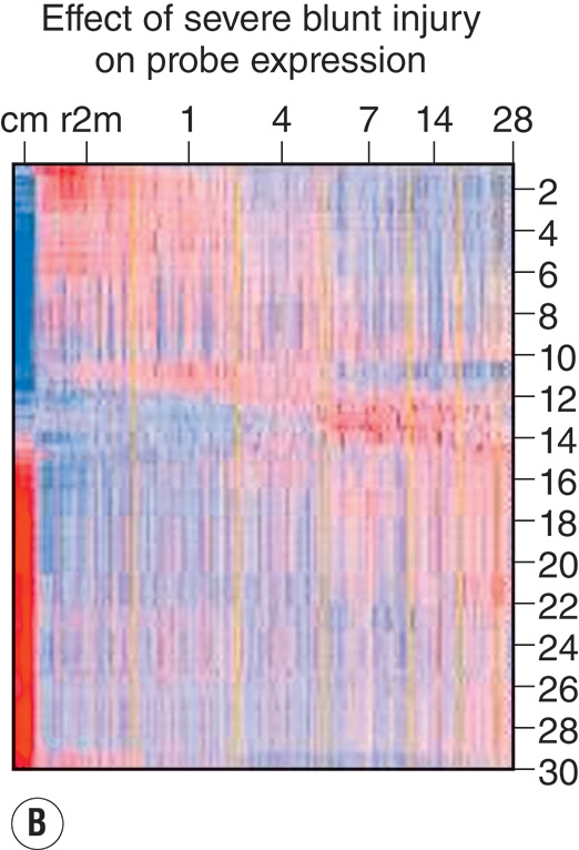 A four-panel view with two heat maps and two bar charts showing temporal leukocyte gene-expression variation after injury, with labeled pathways that are upregulated or downregulated. The view contains four panels labeled A through D. Panel A is titled degree of multiple organ failure and plots days after injury from 0 to 28 along the x-axis and pathways ordered by time to recovery along the y-axis. Rectangular bands fill the grid, forming horizontal zones of varying density that diminish over time from left to right. A key below indicates relative activation level by intensity gradient. Panel B is titled Effect of severe blunt injury on probe expression. The x-axis is labeled days after injury from 1 to 28, and the y-axis lists probe positions numbered from 0 to 30 centimeters. Vertical bands of alternating density extend across the panel. A scale bar to the right shows a numerical range from negative 2 to 6, indicating relative expression intensity. Panel C is titled upregulated pathways with a horizontal axis labeled log p value 0 to 14. Ten horizontal bars extend from left to right and are labeled integrin signaling, leukocyte extravasation, Fc gamma receptor mediated phagocytosis, I L 1 signaling, toll like receptor signaling, ephrin receptor signaling, I L 6 signaling, T R E M 1 signaling, actin cytoskeleton signaling, and B cell receptor signaling. Longer bars appear at the top of the chart. Panel D is titled downregulated pathways with a horizontal axis labeled log p value 0 to 12. Nine bars are labeled calcium dependent T cell apoptosis, I C D S I C S L signaling in T cells, C T L A 4 signaling in C D 8 T cells, C D 28 signaling in T cells, T cell mediated apoptosis, role of N F A T in immune response, I L 4 signaling, primary immunodeficiency signaling, and purine metabolism.