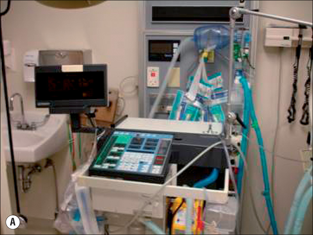 Three photographs of medical equipment used in intensive care, including ventilators, monitors, and other devices for patient care. The three photographs show medical equipment commonly found in intensive care units. The first photograph (A) features a ventilator with attached tubing for respiratory support. The second photograph (B) shows a more detailed ventilator with control panels for adjusting settings. The third photograph (C) displays a touchscreen monitor used for monitoring patient data, including respiratory and other vital signs. These devices are essential for managing patients with critical respiratory conditions or those requiring intensive monitoring and support.
