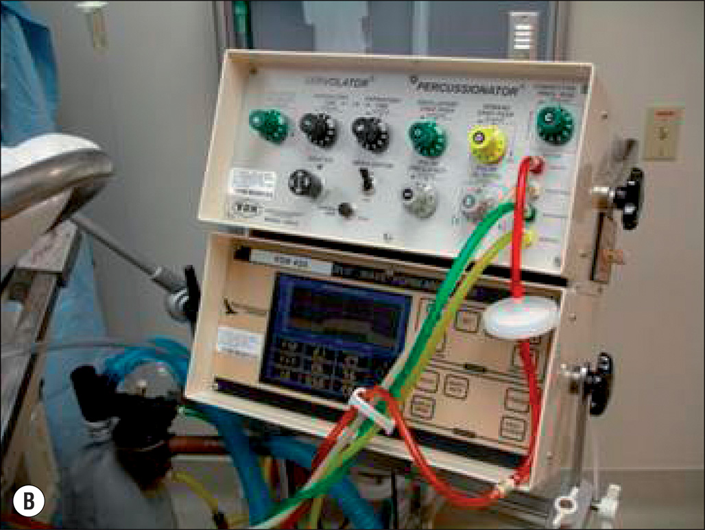 Three photographs of medical equipment used in intensive care, including ventilators, monitors, and other devices for patient care. The three photographs show medical equipment commonly found in intensive care units. The first photograph (A) features a ventilator with attached tubing for respiratory support. The second photograph (B) shows a more detailed ventilator with control panels for adjusting settings. The third photograph (C) displays a touchscreen monitor used for monitoring patient data, including respiratory and other vital signs. These devices are essential for managing patients with critical respiratory conditions or those requiring intensive monitoring and support.
