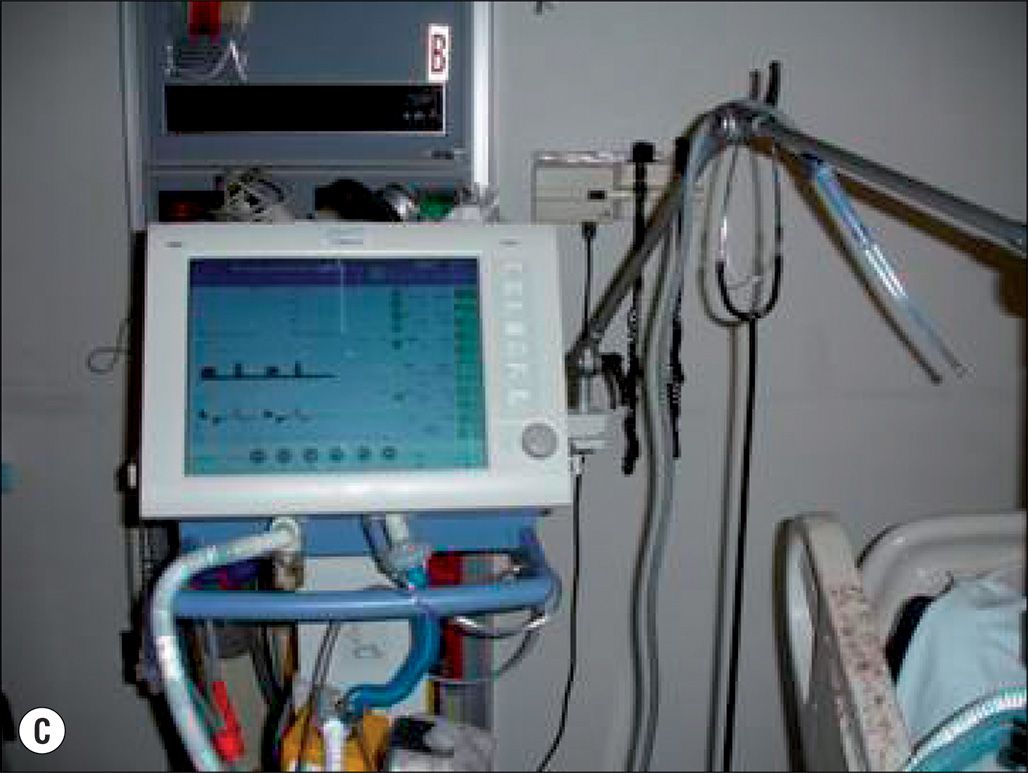 Three photographs of medical equipment used in intensive care, including ventilators, monitors, and other devices for patient care. The three photographs show medical equipment commonly found in intensive care units. The first photograph (A) features a ventilator with attached tubing for respiratory support. The second photograph (B) shows a more detailed ventilator with control panels for adjusting settings. The third photograph (C) displays a touchscreen monitor used for monitoring patient data, including respiratory and other vital signs. These devices are essential for managing patients with critical respiratory conditions or those requiring intensive monitoring and support.