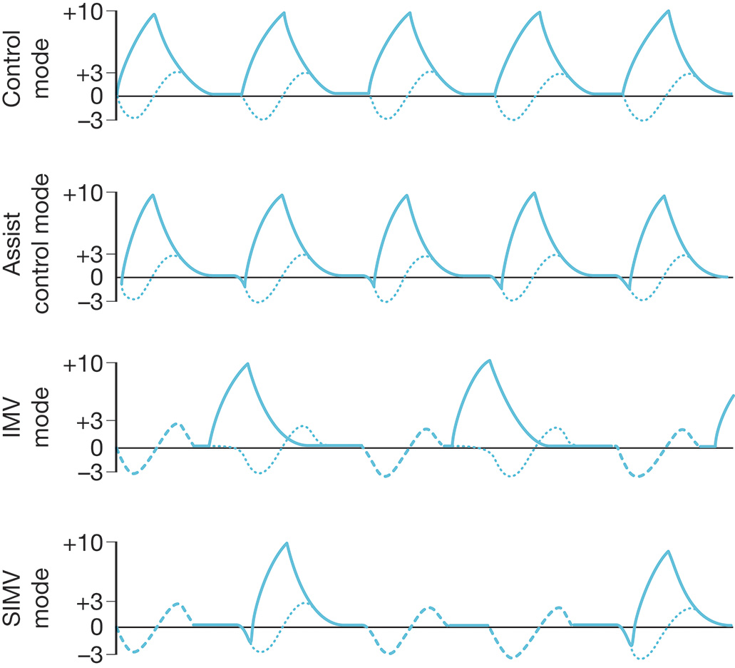Four airway pressure tracings for different volume-cycled modes: control, assist control, IMV, and SIMV, showing ventilator breaths and spontaneous breaths. The illustration displays airway pressure tracings for four different volume-cycled modes of ventilation: control mode, assist control, intermittent mandatory ventilation (IMV), and synchronized intermittent mandatory ventilation (SIMV). Each graph shows a combination of ventilator breaths (represented by thick solid lines) and spontaneous breaths (represented by thin dotted lines). In control mode, the ventilator controls all breaths. In assist control, the ventilator assists with spontaneous breathing. IMV shows a mix of mandatory and spontaneous breaths, while SIMV synchronizes the ventilator with the patient's spontaneous breathing. The pressure tracings illustrate how each mode affects the patient's breathing pattern, with the thick dotted lines showing the natural breathing pattern in the absence of ventilator breaths.