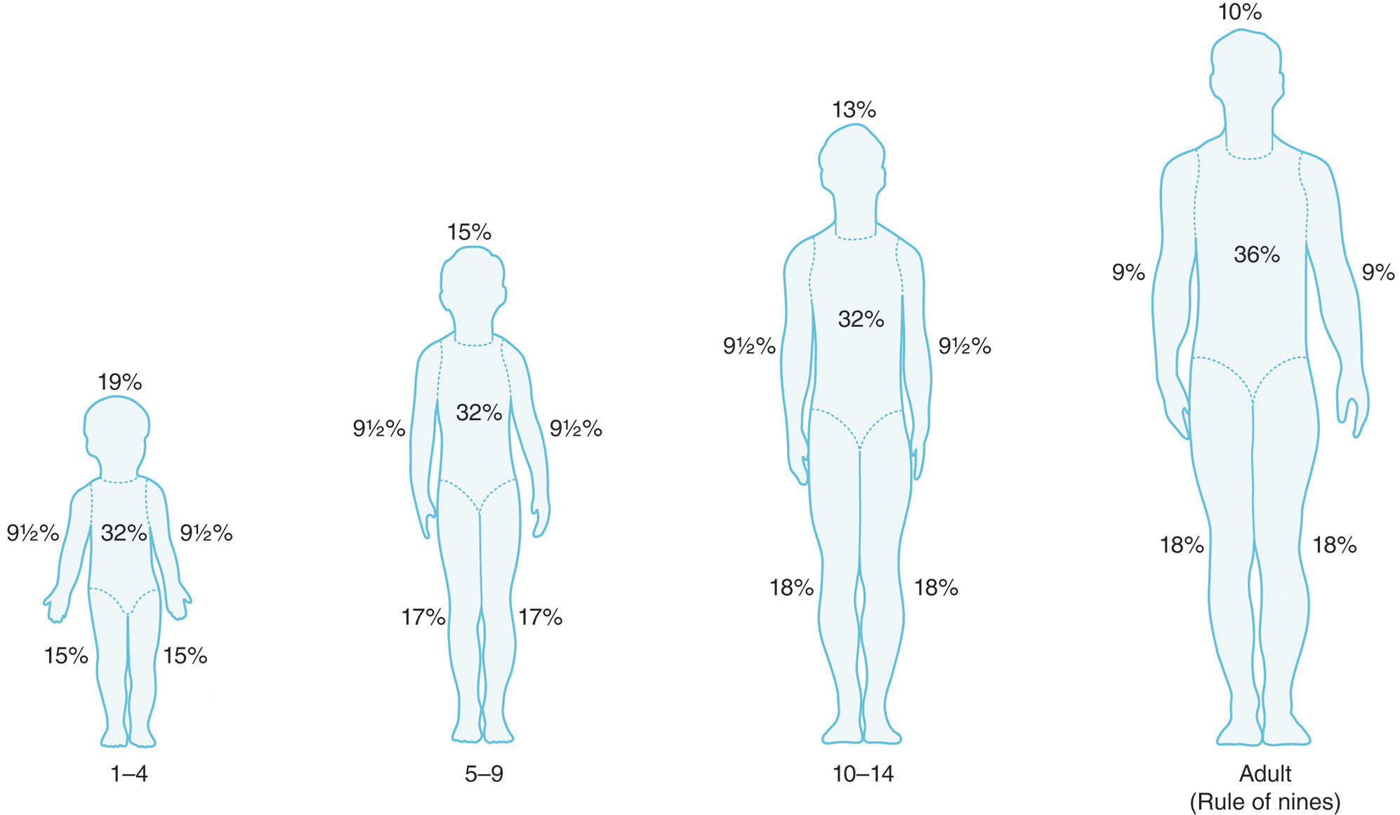 A diagram showing the Rule of Nines, adjusted for pediatric patients (1-4, 5-9, 10-14 years) to account for larger head and smaller leg proportions compared to the adult body. The illustrative chart demonstrates the Rule of Nines as adapted for pediatric patients, reflecting the anthropomorphic differences compared to adults. The diagram shows four figures: 1 to 4 years, 5 to 9 years, 10 to 14 years, and Adult labeled Rule of Nines. The percentages assigned to the head and legs change with age. The head is the largest in children, 18 percent in the 1 to 4 year old, and decreases to 9 percent in adults. Conversely, the legs are smallest in children, 13.5 percent each in the 1 to 4 year old, and increase to 18 percent each in adults. The torso (front and back) and arms generally maintain a consistent percentage across all age groups.