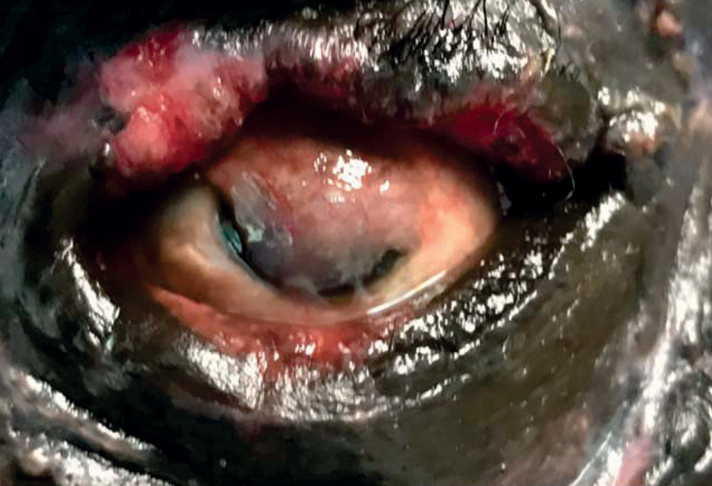 A photograph shows the corneal surface completely covered by a conjunctival graft that extends from the surrounding tissue. The cornea is obscured, and the eyelid edges are partially retracted.