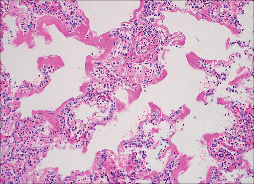 A micrograph shows multiple rounded alveolar spaces separated by thin continuous septa lined with smooth membranes, showing even spacing and intact boundaries across the lung tissue field.