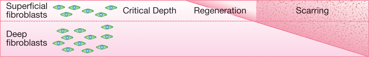 A rectangle-shaped sketch with labels denoting the process of regeneration of scarred tissue. In the top layer, the labels are superficial fibroblasts with an illustration, critical depth, regeneration, and scarring. In the bottom layer, the label is deep fibroblasts with an illustration of fibroblasts. The fibroblasts in both layers appear similar to an eye icon. The scarring part in the top layer is full of spots, while a diagonal line from regeneration extends into the scarring part in the bottom layer and partitions it into spot-free and spotty tissue.