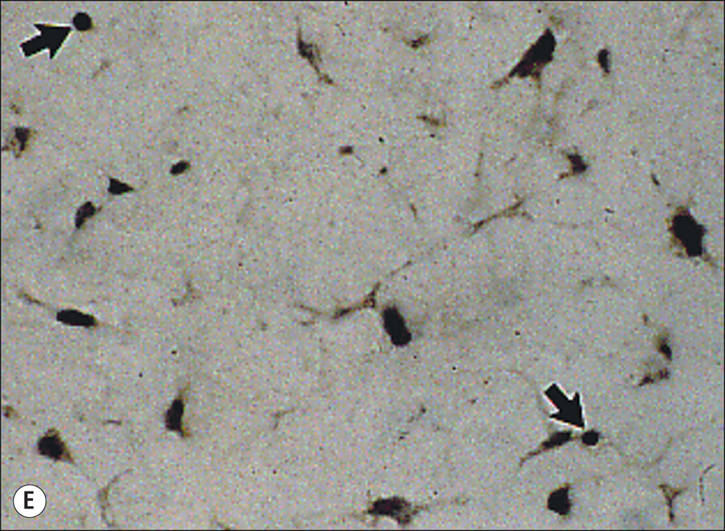 Six microscopic images, labeled A to F, show cellular structures related to hypertrophic scar formation. Six panels labeled A through F, each showing microscopic views of cells. Panel A shows scattered elongated cells. Panel B displays a few elongated cells with more defined outlines. Panel C presents a close-up of an elongated cell with visible extensions. Panel D shows clusters of small rounded cells. Panel E depicts scattered dark cells with arrows pointing to specific features. Panel F shows two adjacent cells with clearly visible nuclei.