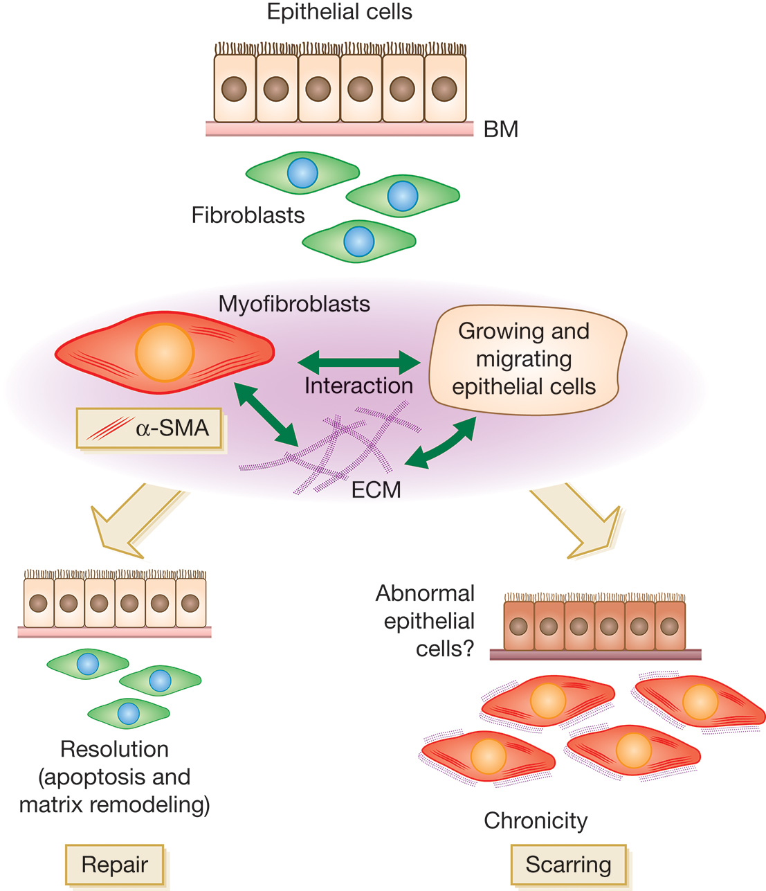 A flow diagram shows the role of cytokines in hypertrophic scar formation. The diagram starts with a sketch of epithelial cells at the top, labeled with B M at the base. Beneath them are fibroblasts resembling an eye, followed by myofibroblasts with a labeled alpha S M A outside it. Cyclic connection between arrows indicate interactions between myofibroblasts and growing and migrating epithelial cells, and a labeled E C M. The diagram bifurcates into two pathways: one leading to a title, repair with label that reads resolution (apoptosis and matrix remodeling), and another leading to scarring with abnormal epithelial cells? and chronicity. Scarring has myofibroblasts and discolored epithelial cells while repair has normal epithelial cells and fibroblasts.
