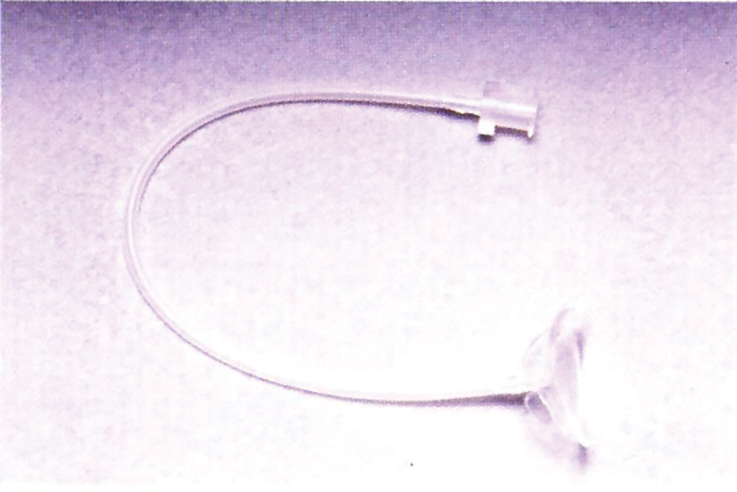 A photo of a Morgan lens, a curved medical device with tubing attachments. The photo shows a Morgan lens, a curved transparent medical device with attached tubing on both ends. The lens has a concave shape designed to conform to the eye surface, with thin flexible tubing extending from the device for fluid delivery.