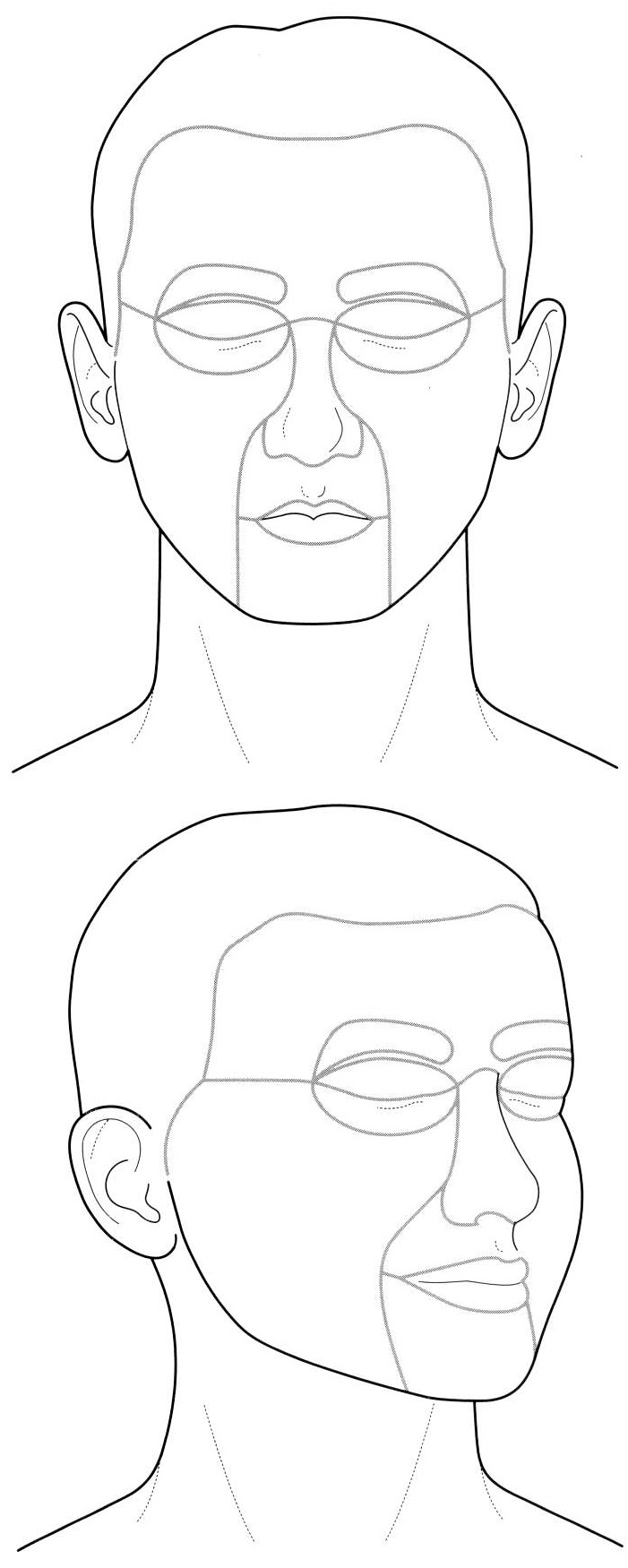 A diagram of aesthetic facial units is depicted from frontal and lateral views. The diagram features aesthetic facial units with demarcation lines dividing the face into distinct regions. The top panel presents a frontal view with lines outlining areas such as the forehead, periorbital regions, nose, cheeks, lips, and chin. The bottom panel shows a lateral view with corresponding divisions of aesthetic units along the side profile of the face and neck.
