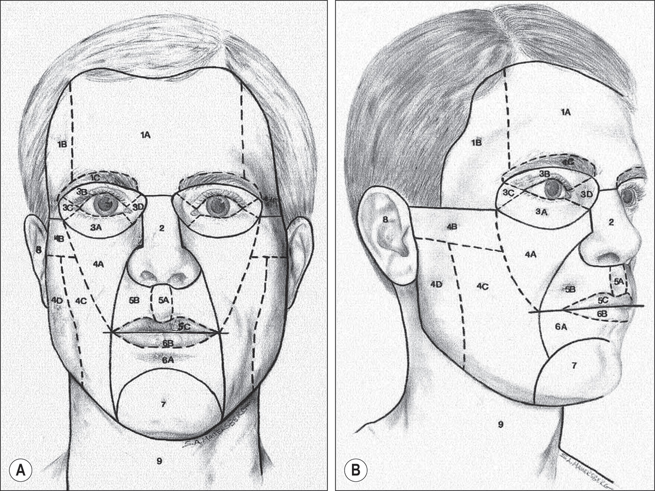 Two diagrams labeled A and B show frontal and profile views of facial aesthetic units and subunits with numbered regions and labeled subdivisions. The diagram shows facial aesthetic units in a modified version of Gonzales-Ulloa's units. Panel A presents a frontal view and Panel B presents a profile view of the aesthetic units and subunits of the face. The forehead unit is labeled 1, with 1A marking the central subunit, 1B marking the lateral subunit, and 1C marking the eyebrow subunit. The nasal unit is labeled 2. The eyelid units are labeled 3, with 3A marking the lower lid unit, 3B marking the upper lid unit, 3C marking the lateral canthal subunit, and 3D marking the medial canthal subunit. The cheek unit is labeled 4, with 4A marking the medial subunit, 4B marking the zygomatic subunit, 4C marking the lateral subunit, and 4D marking the buccal subunit. The upper lip unit is labeled 5, with 5A marking the philtrum subunit, 5B marking the lateral subunit, and 5C marking the mucosal subunit. The lower lip unit is labeled 6, with 6A marking the central subunit and 6B marking the mucosal subunit. The mental unit is labeled 7. The auricular unit is labeled 8. The neck unit is labeled 9.
