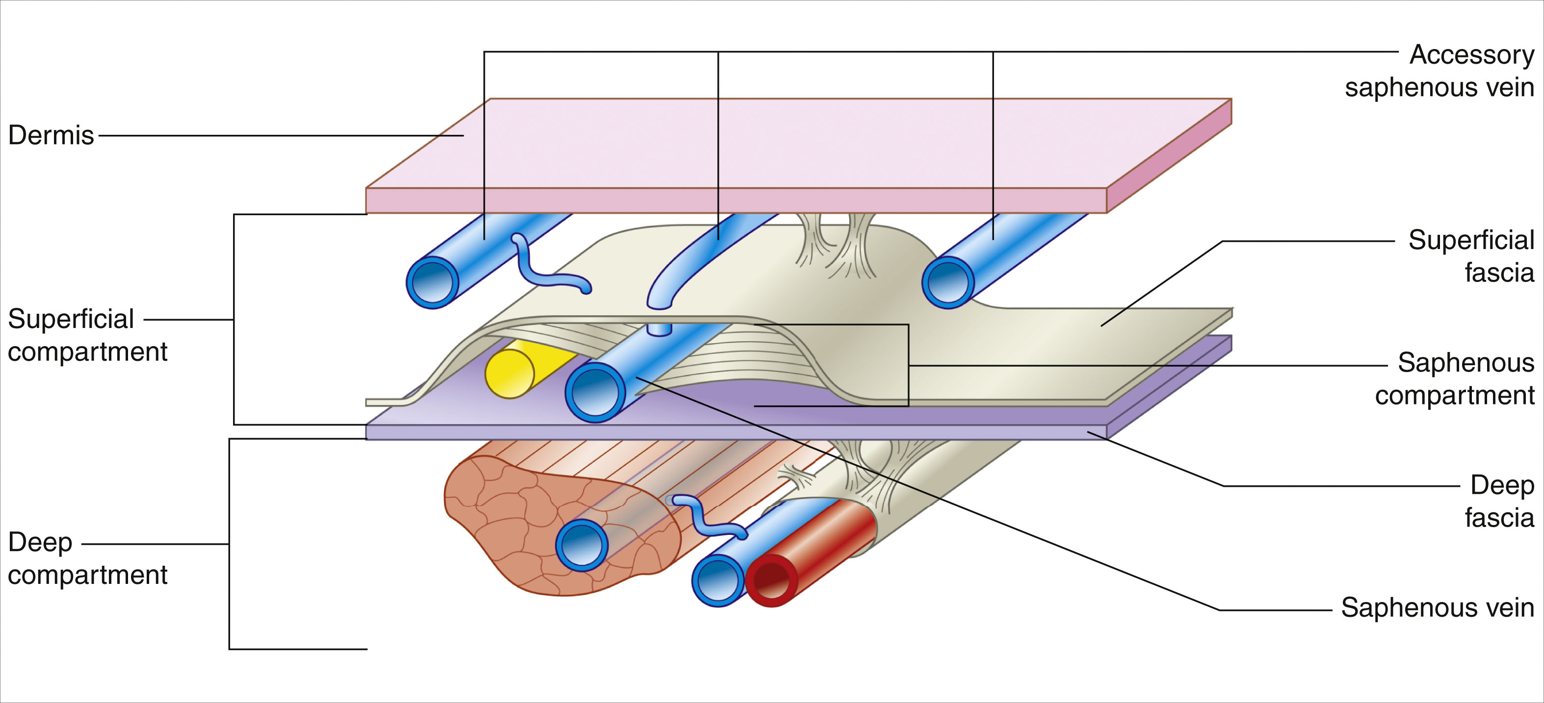 A labeled anatomical diagram of the saphenous compartment with labeled veins, fascia, and compartments. The labeled anatomical diagram shows layers and structures of the leg. The top layer is the dermis. Below it lies the superficial compartment, followed by superficial fascia. The saphenous compartment is positioned beneath the superficial fascia and contains the saphenous nerve and saphenous vein. The deep fascia separates the saphenous compartment from the deep compartment. The deep compartment contains muscle and the deep vein. On the left, the accessory saphenous vein and the anterior and lateral accessory saphenous veins enter the superficial compartment.