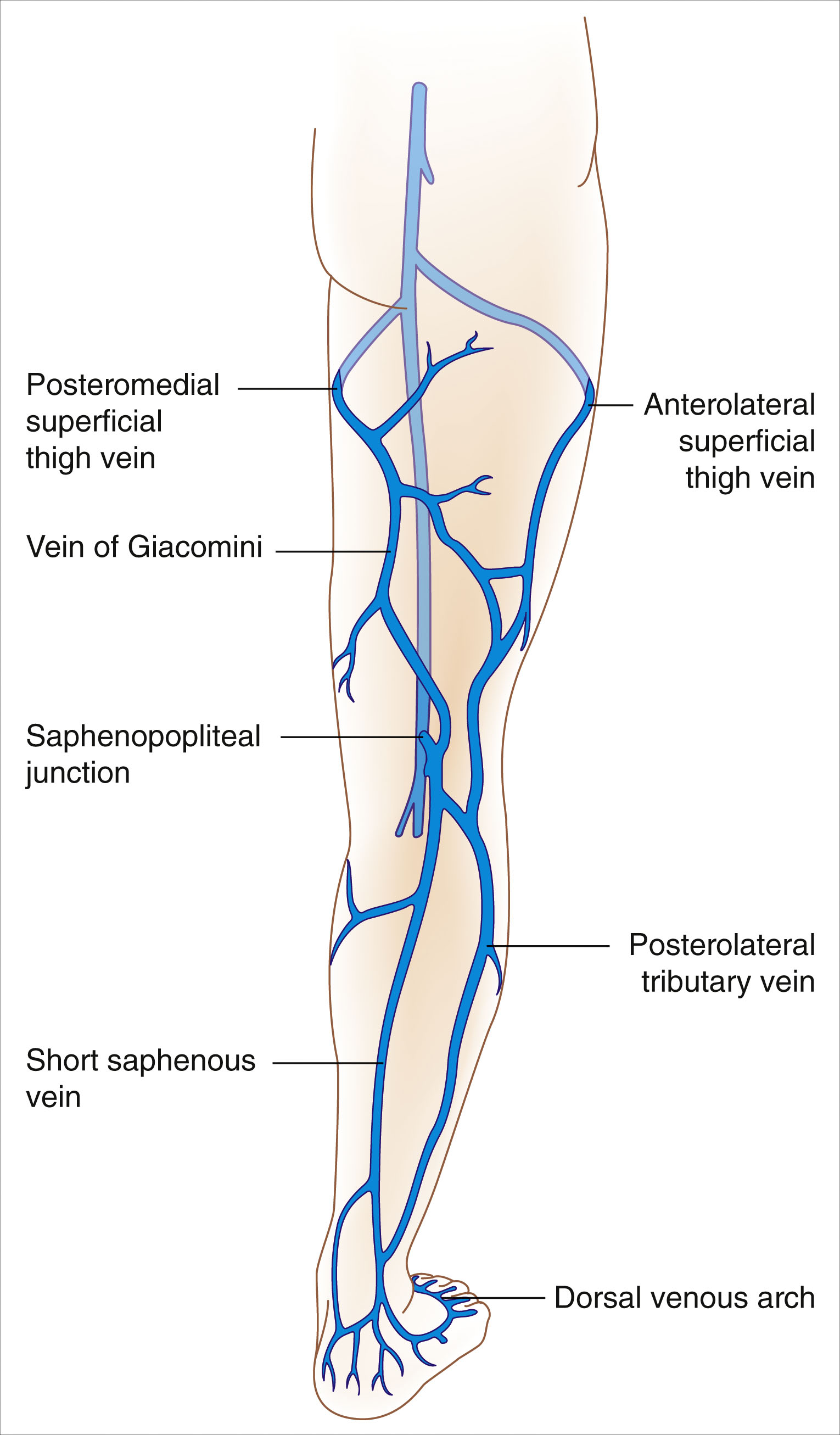 A posterior view diagram of the leg shows the small saphenous vein and its labeled branches. The posterior view diagram of a human leg displays the small saphenous vein running from the dorsal venous arch of the foot upward along the back of the leg. Labeled structures include the posterior medial thigh vein, the posterior lateral thigh vein, and the posterior accessory vein. The posterior arch vein and the anterior lateral tributary vein are labeled near the lower leg. The vein of Giacomini connects to the small saphenous vein and extends upward toward the thigh. The saphenopopliteal junction is marked at the upper portion of the calf.