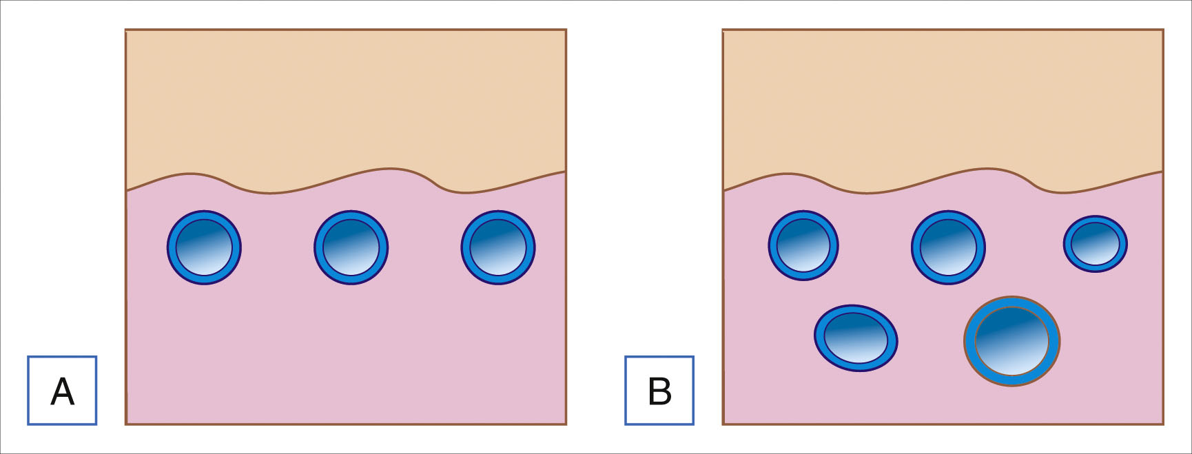 A side-by-side comparison shows three evenly spaced circular vessels in section A and five unevenly sized and spaced vessels in section B. The side-by-side comparison is labeled A and B. The left section labeled A shows three circular vessels placed at a similar depth below a wavy upper surface. Each vessel has a similar size and equal spacing. The right section labeled B shows five vessels that vary in size and depth. One vessel appears larger than the others. The vessels in section B are unevenly spaced and placed at different levels below the surface.