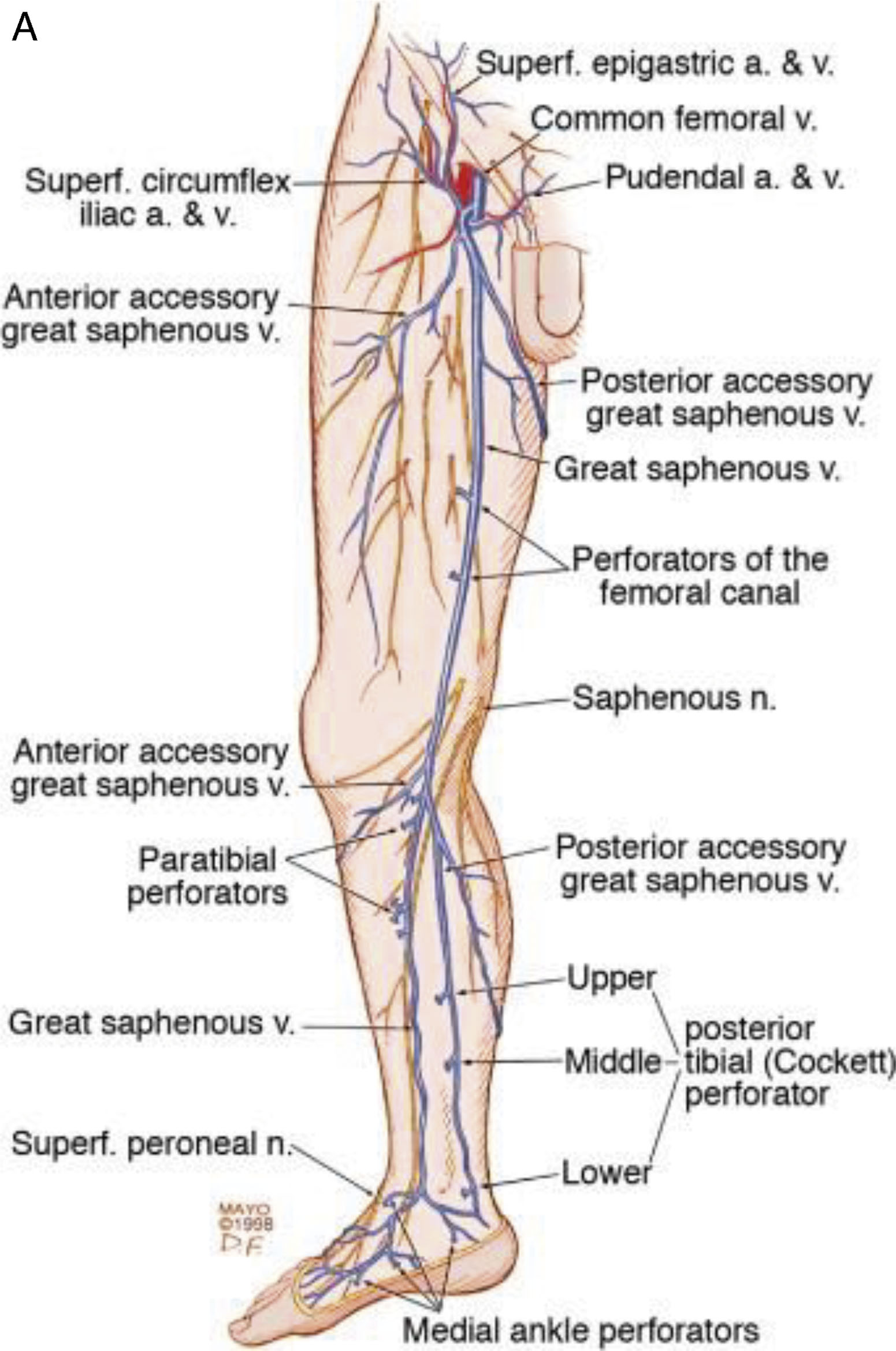 An anatomical diagram of the great saphenous vein, short saphenous vein, and perforators in the leg. The anatomical diagram includes three labeled panels, A, B, and C. Panel A shows the anatomy of the great saphenous vein along the medial aspect of the leg. Labeled structures include the superficial epigastric vein, accessory saphenous vein, superficial circumflex iliac vein, anterior cutaneous branch of femoral nerve, anterior accessory saphenous vein, posterior accessory saphenous vein, vein of Giacomini, medial marginal vein, and dorsal venous arch. Panel B shows the short saphenous vein along the posterior aspect of the lower leg with labels for sural nerve, vein of Giacomini, posterior accessory saphenous vein, lateral marginal vein, and dorsal venous arch. Panel C shows a cross-sectional diagram of the leg with labels for superficial vein, deep vein, musculofascial layer, and perforating vein. All three panels clearly show vein pathways and anatomical relationships with labeled branches and structures.