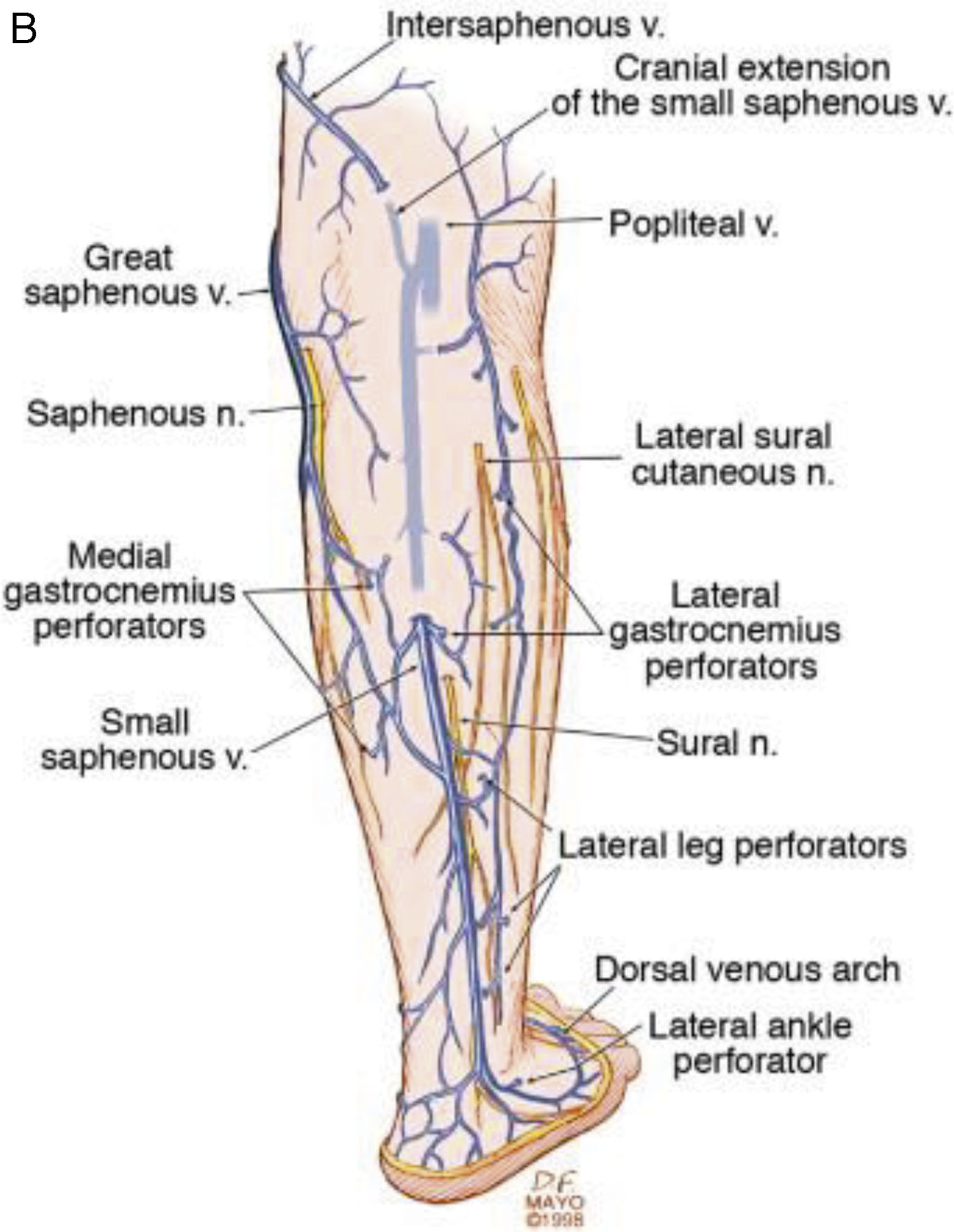 An anatomical diagram of the great saphenous vein, short saphenous vein, and perforators in the leg. The anatomical diagram includes three labeled panels, A, B, and C. Panel A shows the anatomy of the great saphenous vein along the medial aspect of the leg. Labeled structures include the superficial epigastric vein, accessory saphenous vein, superficial circumflex iliac vein, anterior cutaneous branch of femoral nerve, anterior accessory saphenous vein, posterior accessory saphenous vein, vein of Giacomini, medial marginal vein, and dorsal venous arch. Panel B shows the short saphenous vein along the posterior aspect of the lower leg with labels for sural nerve, vein of Giacomini, posterior accessory saphenous vein, lateral marginal vein, and dorsal venous arch. Panel C shows a cross-sectional diagram of the leg with labels for superficial vein, deep vein, musculofascial layer, and perforating vein. All three panels clearly show vein pathways and anatomical relationships with labeled branches and structures.