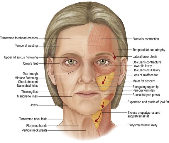 Facelift Plastic Surgery Key