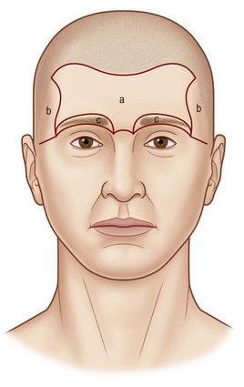 forehead scalp reconstruction central units bilateral temporal eyebrow aesthetic fig region unit two