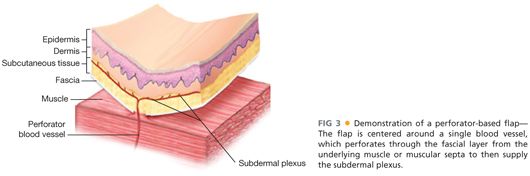 Advancement And Rotational Flaps Plastic Surgery Key