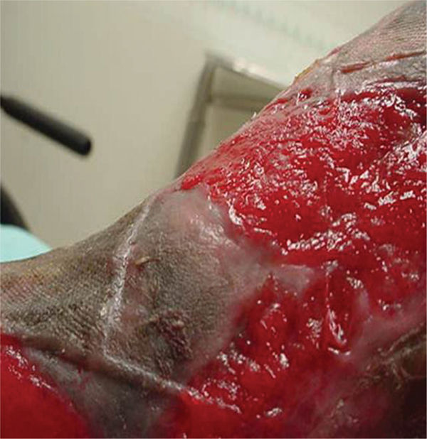 epithelial tissue wound