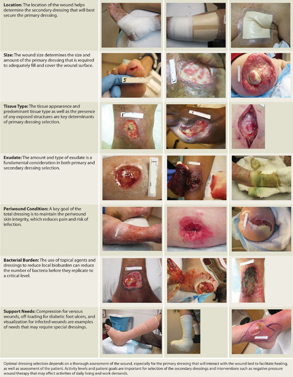 Wound Dressings | Online CPD Course | Ausmed
