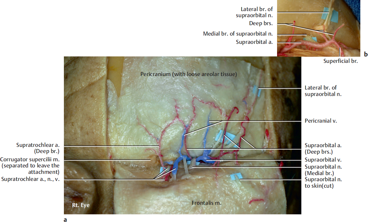 supratrochlear artery