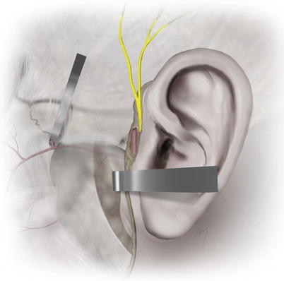 A270654_1_En_5_Fig30_HTML.jpg