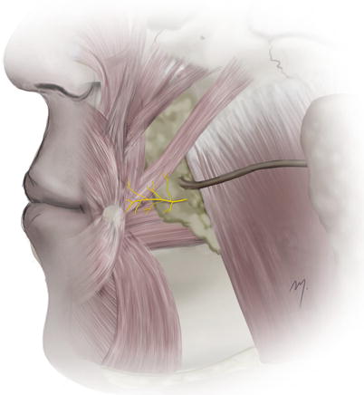 A270654_1_En_5_Fig31_HTML.jpg