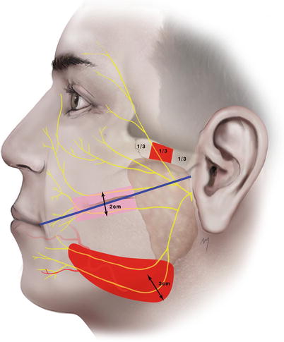 A270654_1_En_5_Fig34_HTML.jpg