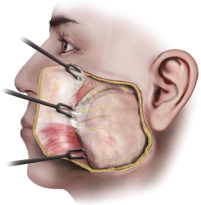 A270654_1_En_5_Fig36_HTML.jpg