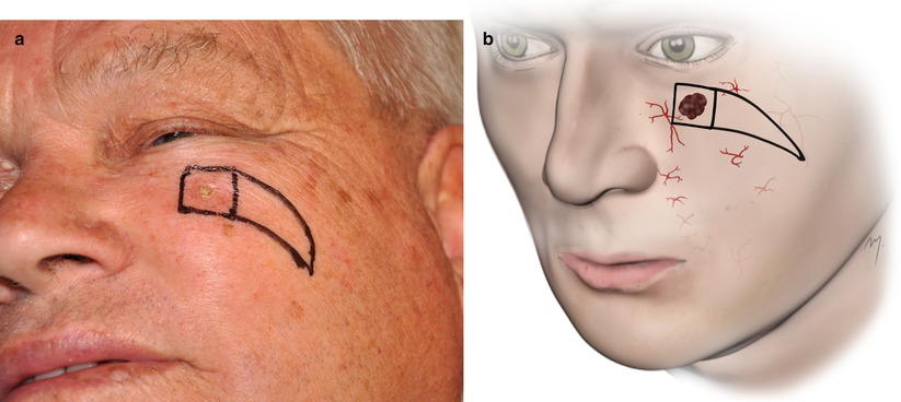 A270654_1_En_5_Fig45a_HTML.jpg