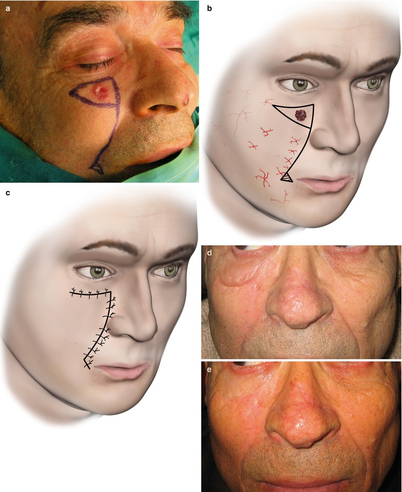 A270654_1_En_5_Fig56_HTML.jpg