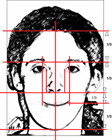 Aesthetic Analysis of the Face: The Maxillofacial Deformity | Plastic ...