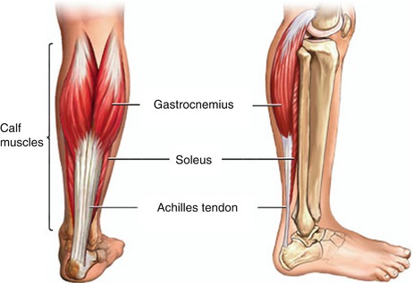 Calf Augmentation | Plastic Surgery Key