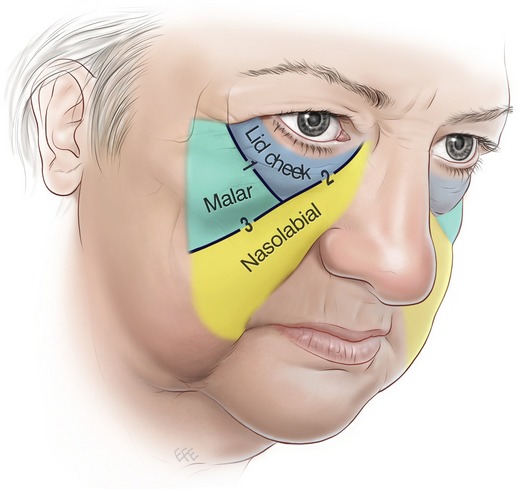 face surface anatomy