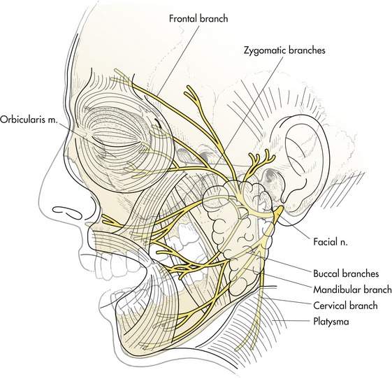 Abnormal Movements of the Face | Plastic Surgery Key